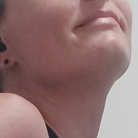 adorablegains Nøgen