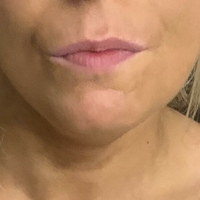 Holytits Nøgen