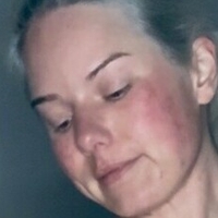 kaepiglet Nøgen